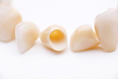 dental crowns in charlotte nc